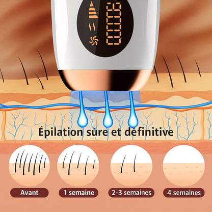 SoieLumière™ IPL Prestige – Épilateur à lumière pulsée