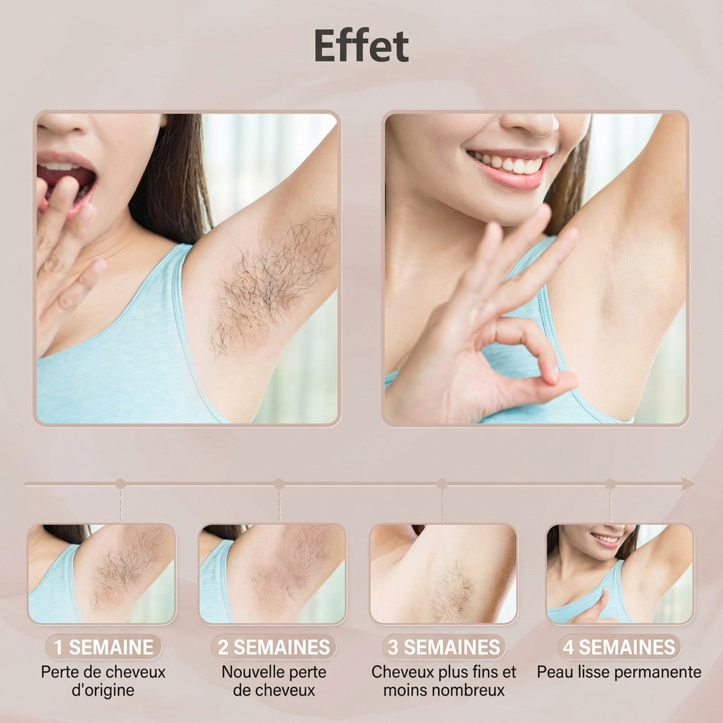 SoieLumière™ IPL Prestige – Épilateur à lumière pulsée