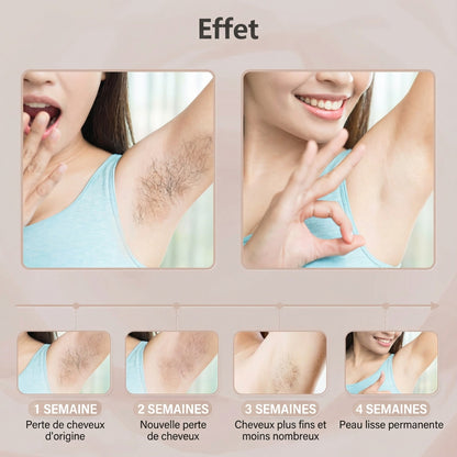 SoieLumière™ IPL Prestige – Épilateur à lumière pulsée